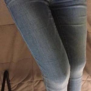 貴陽華美整形美容醫(yī)院醫(yī)生田永華做大腿吸脂效果怎么樣？附大腿吸脂案例前后對比圖