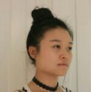 鄭州管城中醫(yī)院整形美容中心醫(yī)生張秀英做注射瘦臉怎么樣？附除皺瘦臉案例效果圖