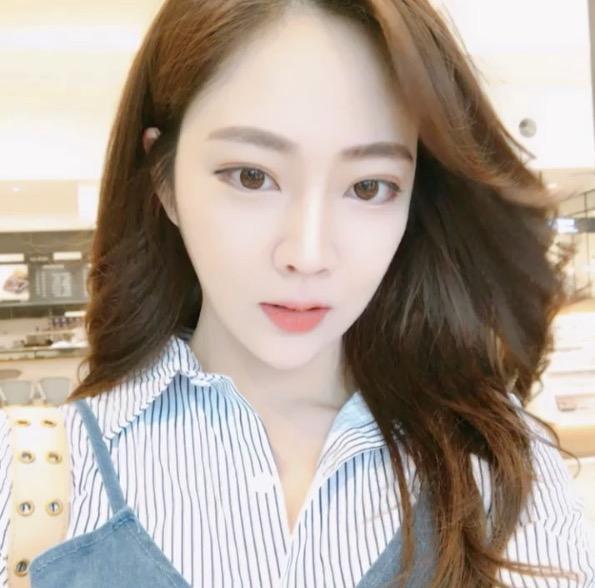 廣州中科美整形醫(yī)院醫(yī)生鄭志敏做鼻部多項(xiàng)綜合整形怎么樣？附案例效果圖