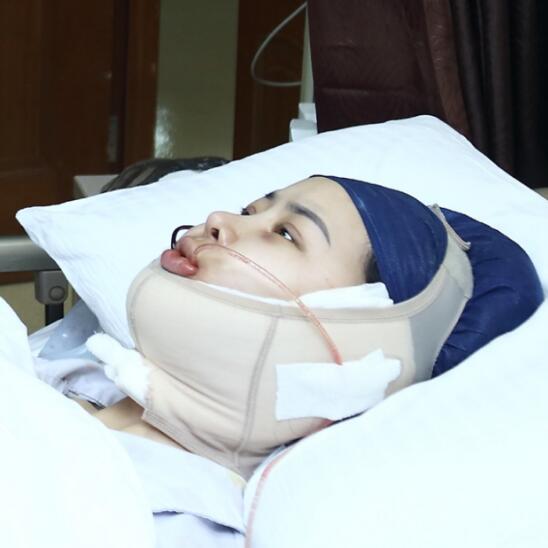 上海時光整形外科醫(yī)院醫(yī)生李靜林做假體隆鼻和反頜手術(shù)怎么樣？