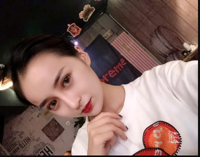 武漢米蘭醫(yī)療美容醫(yī)生柳再億做眼綜合+鼻綜合整形怎么樣？附真實案例對比圖