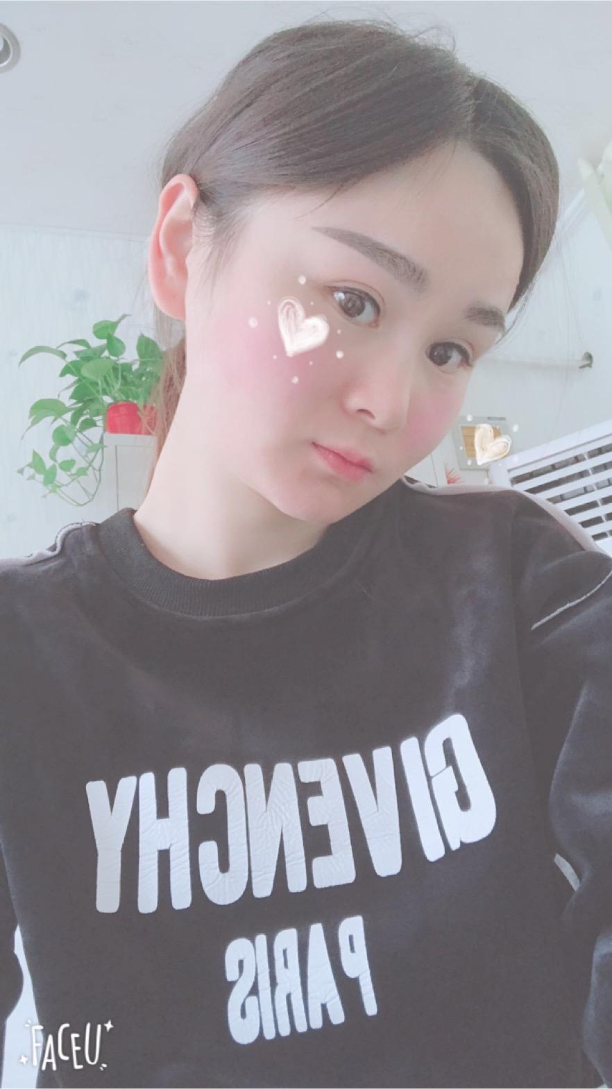 北京彤美美容整形醫(yī)院醫(yī)生楊曉惠做顴骨內(nèi)推+面部吸脂手術(shù)效果怎么樣？附案例