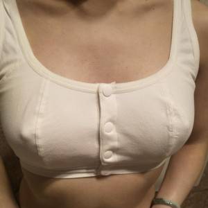 長(zhǎng)沙亞韓醫(yī)學(xué)美容醫(yī)院醫(yī)生鄭京湘做假體隆胸怎么樣？附醫(yī)生案例效果對(duì)比圖