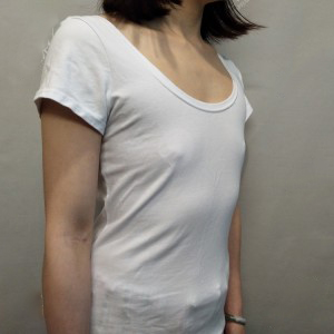 長(zhǎng)沙亞韓醫(yī)學(xué)美容醫(yī)院醫(yī)生鄭京湘做假體隆胸怎么樣？附醫(yī)生案例效果對(duì)比圖