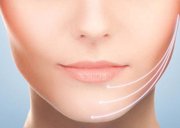 阜陽微悅整形醫(yī)院下頜角整形