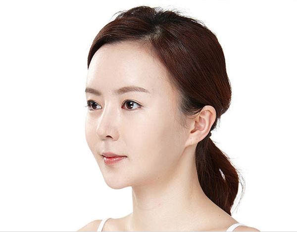 廣州鴻業(yè)醫(yī)學(xué)美容門診部下頜角整形