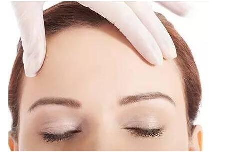 潮州愛(ài)爾眼科醫(yī)院自體脂肪豐額頭