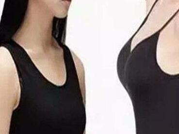 大連沙醫(yī)生整形美容口腔?？漆t(yī)院自體脂肪豐胸