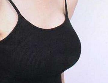 福州新時代醫(yī)療美容門診部乳房下垂矯正