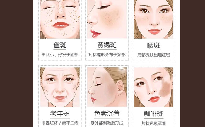 醫(yī)院激光祛斑貴不貴？正規(guī)醫(yī)院激光祛斑多少錢？