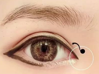 上海華美醫(yī)療美容醫(yī)院開眼角