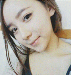 上海時(shí)光整形醫(yī)生何晉龍做假體隆鼻效果怎么樣？附案例效果對(duì)比圖