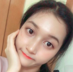 上海時(shí)光整形醫(yī)院做面部玻尿酸注射效果怎么樣？