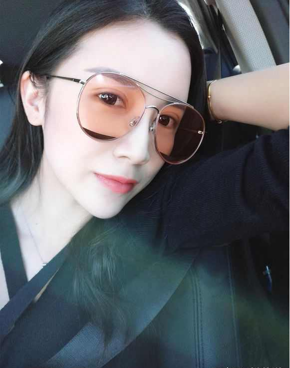 上海時光整形醫(yī)院張晶醫(yī)生做開眼角怎么樣？附真實效果圖