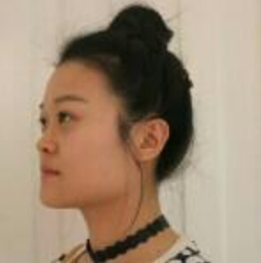 上海時光整形醫(yī)院左雯君醫(yī)生注射瘦臉針效果怎么樣？附真實案例圖