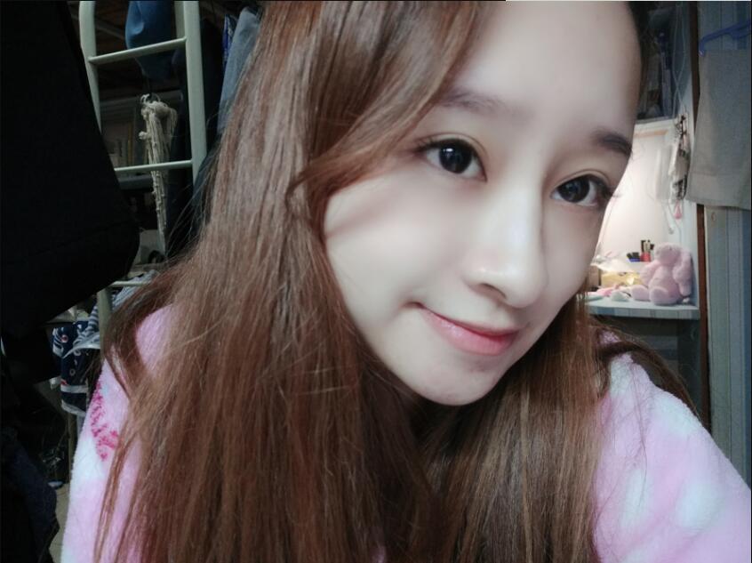 上海時(shí)光整形做玻尿酸注射隆鼻效果怎么樣？附陳文慧醫(yī)生真實(shí)案例對(duì)比圖