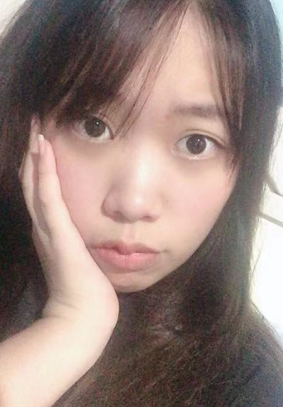 合肥韓美整形美容醫(yī)院做去眼袋效果怎么樣?附金壽信醫(yī)生去眼袋案例效果圖