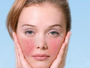 南京華韓奇致美容醫(yī)院激光去紅血絲