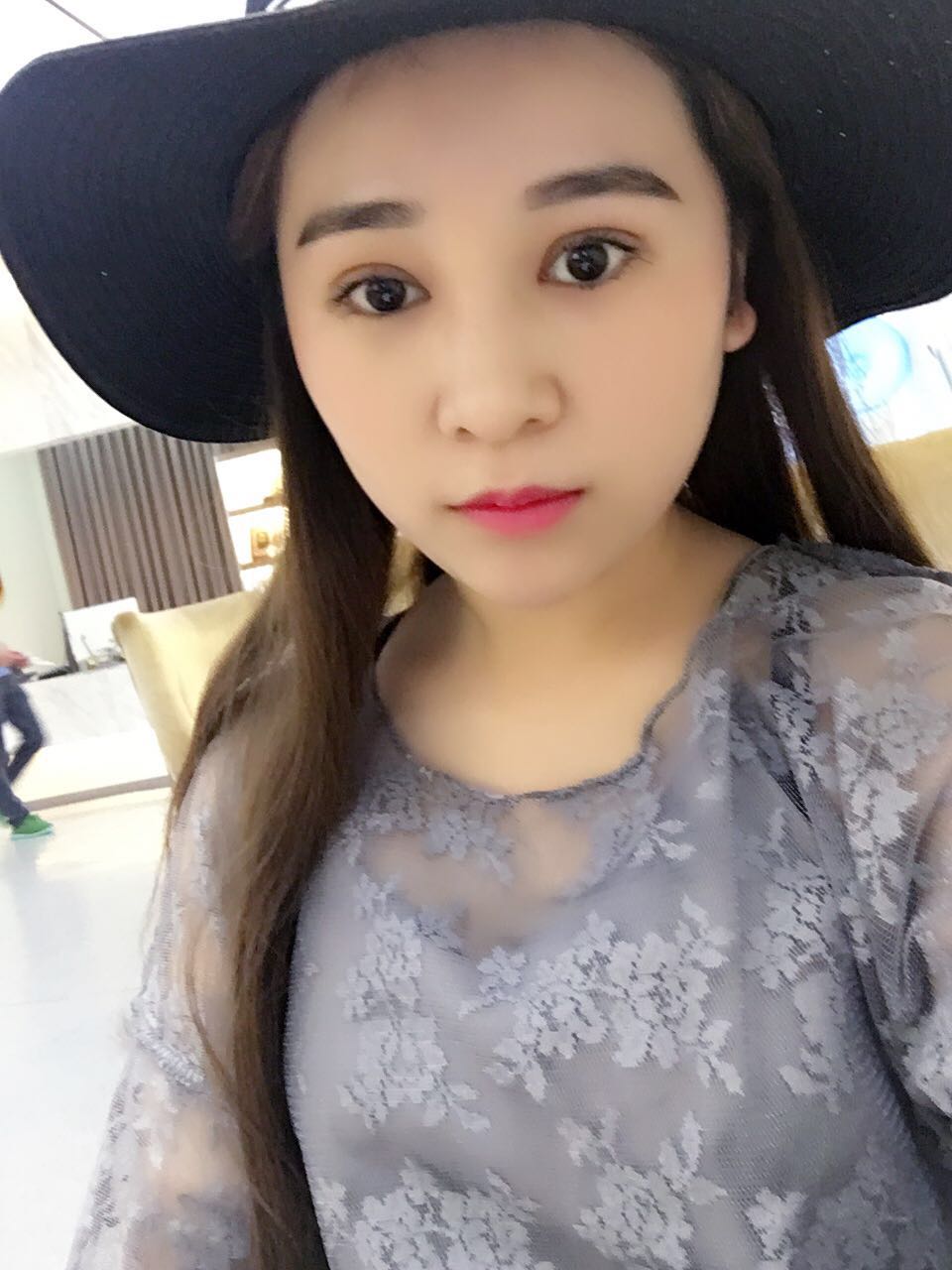 蚌埠韓美美萊整形醫(yī)生鄭捷做開眼角怎么樣？附案例效果圖