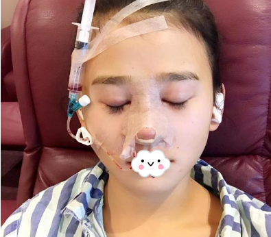 蚌埠韓美美萊整形醫(yī)生歷芳做耳軟骨隆鼻怎么樣？附耳軟骨隆鼻案例對比圖