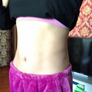 蚌埠韓美美萊整形醫(yī)生張濤做水動力吸脂怎么樣？附吸脂案例效果圖