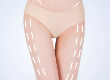 沈陽杏林整形美容醫(yī)院大腿吸脂