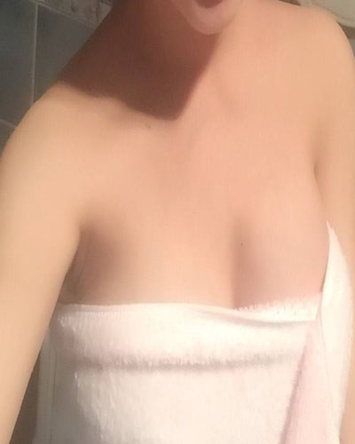 安慶市立醫(yī)院整形外科華棟醫(yī)生做自體脂肪隆胸效果怎么樣？附真實(shí)案例圖