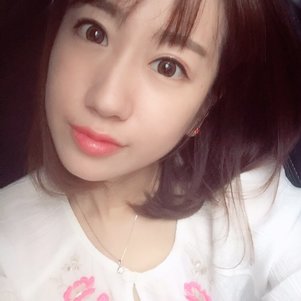 蚌埠韓美美萊整形做玻尿酸面部除皺效果怎么樣？附陳澤醫(yī)生案例效果圖