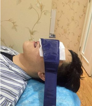 鞍山燕麗醫(yī)療美容醫(yī)院薛媚醫(yī)生做去眼袋效果怎么樣？附案例效果對比圖