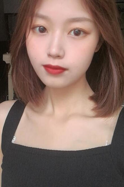 安陽市人民醫(yī)院燒傷整形中心做手術激光祛斑效果怎么樣？附案例效果對比圖