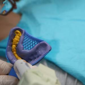 鞍山時代口腔門診部做瓷貼面案例效果圖