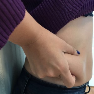 蚌埠韓美美萊整形醫(yī)生張濤做水動力吸脂怎么樣？附吸脂案例效果圖