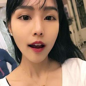 鞍山時(shí)代口腔門診部洗牙效果怎么樣？附申元休醫(yī)生洗牙案例效果圖