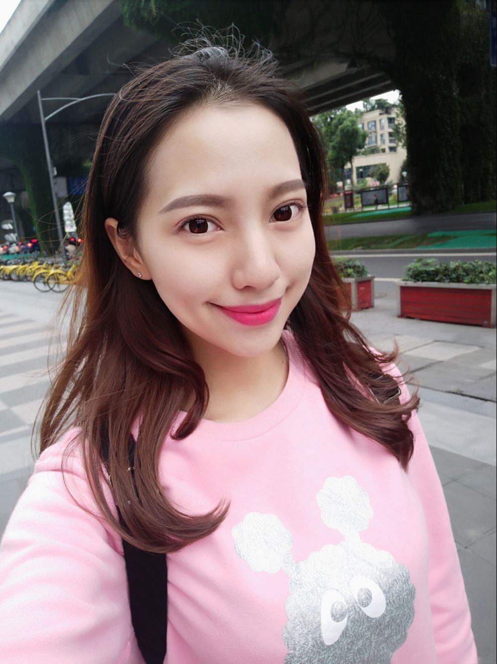 巴中華醫(yī)口腔醫(yī)院做牙齒矯正效果好嗎？附母汶靈醫(yī)生牙齒矯正案例效果圖