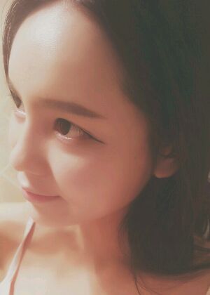 鞍山王景醫(yī)療美容外科診所做自體脂肪豐蘋(píng)果肌效果怎么樣？附張婉鸝案例效果圖