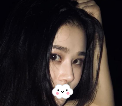 蚌埠韓美美萊整形醫(yī)生歷芳做耳軟骨隆鼻怎么樣？附耳軟骨隆鼻案例對比圖