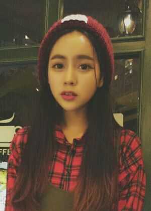 鞍山王景醫(yī)療美容外科診所做自體脂肪豐蘋(píng)果肌效果怎么樣？附張婉鸝案例效果圖