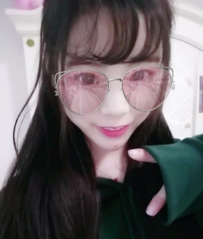 保定市第五醫(yī)院美容整形科做玻尿酸墊下巴怎么樣？附楊瑞萍醫(yī)生案例效果圖