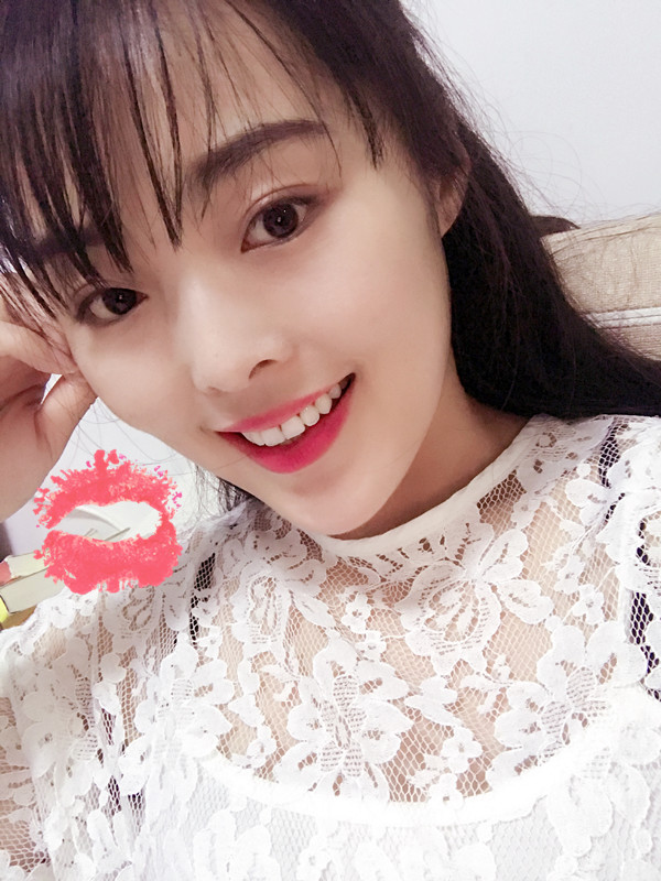 保定東陽口腔醫(yī)院白小青醫(yī)生做牙齒矯正怎么樣?附牙齒矯正案例效果對(duì)比圖