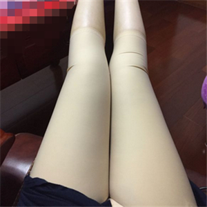 保定市第五醫(yī)院美容整形科做大腿吸脂怎么樣？附劉根立醫(yī)生案例效果圖