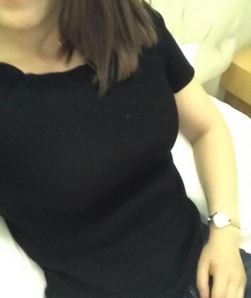 保定現(xiàn)代女子醫(yī)院整形美容中心做腰腹部吸脂怎么樣？附林秀蓮醫(yī)生案例效果圖