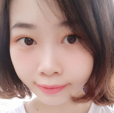 保定安卓貝拉醫(yī)療美容門診部孫大山醫(yī)生做雙眼皮+去眼袋怎么樣？附案例效果對比圖