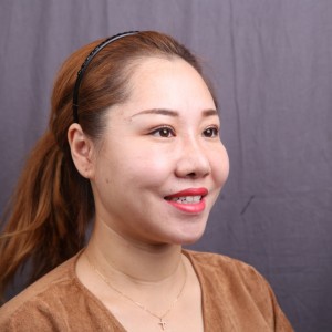 保定東陽(yáng)口腔醫(yī)院趙晨醫(yī)生做瓷貼面怎么樣?附瓷貼面案例效果對(duì)比圖