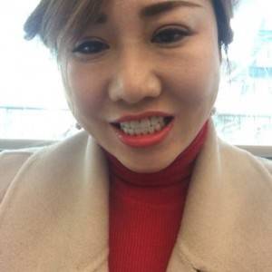 保定東陽(yáng)口腔醫(yī)院趙晨醫(yī)生做瓷貼面怎么樣?附瓷貼面案例效果對(duì)比圖