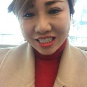 保定東陽口腔醫(yī)院趙晨醫(yī)生做瓷貼面怎么樣？附瓷貼面案例效果對比圖