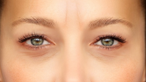 割眼袋要注意什么？