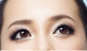 激光去黑眼圈多少錢(qián)？激光去黑眼圈效果好嗎？