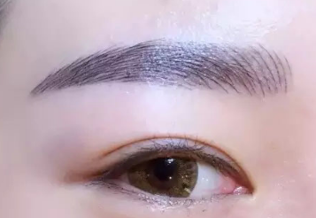 除皺去眼袋需要多少錢？價(jià)格貴嗎？