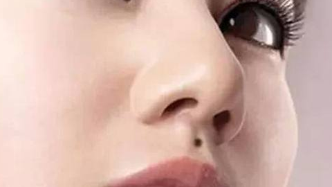 綜合隆鼻價(jià)格需要多少錢(qián)？?jī)r(jià)格貴嗎？