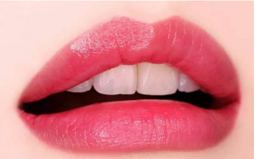 玻尿酸豐唇能保持多長時(shí)間？保持效果時(shí)間長嗎？